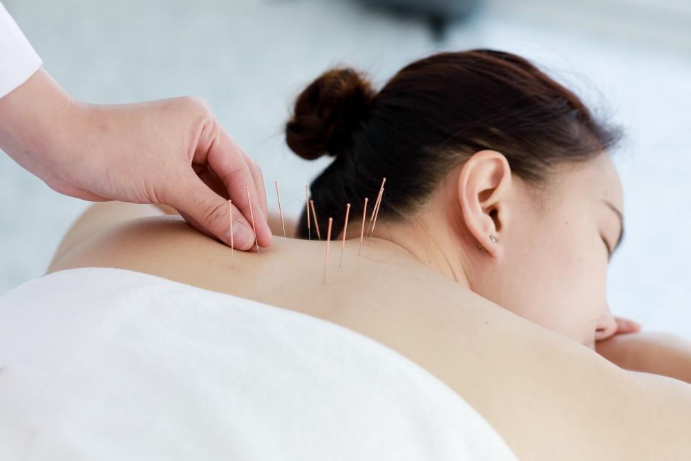 5 Easy Acupuncture Therapy Techniques For Pain Relief